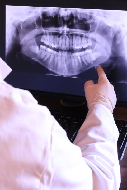 Best Emergency Root Canal Treatment in Fowlerville, MI
