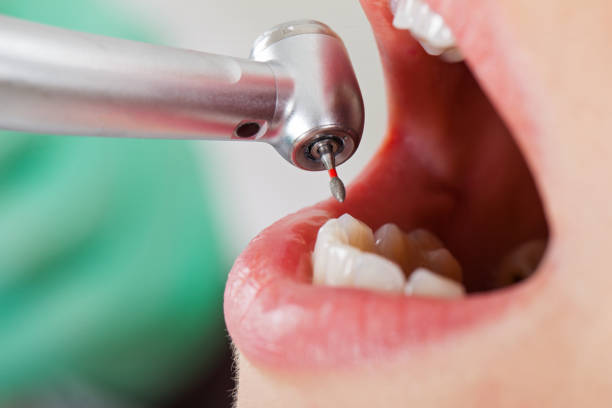 Best Emergency Gum Treatment in Fowlerville, MI